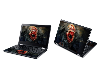 Acer Chromebook R11 Horror