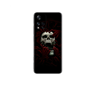 Xiaomi 11i  Skull